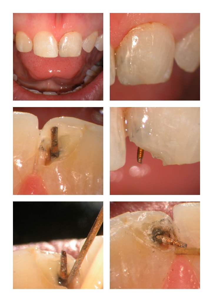 DB anterior case pg 3.jpg